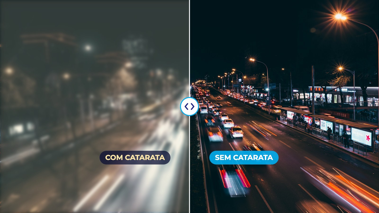 Catarata: como saber se chegou a hora de operar